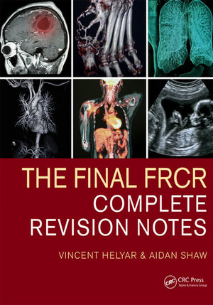 The Final FRCR: Complete Revision Notes Book A Book Medical