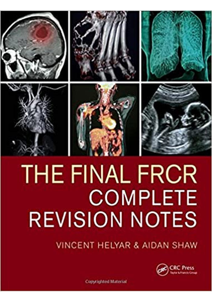 The Final FRCR: Complete Revisio Book A Book Medical