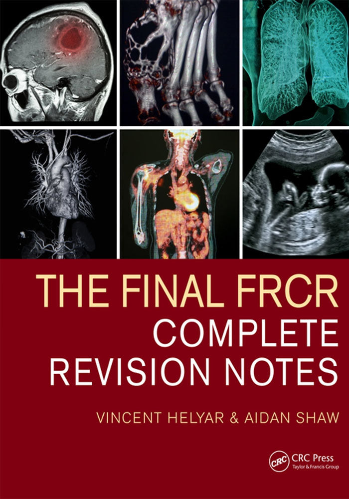 The Final FRCR: Complete Revision Notes Book A Book Medical